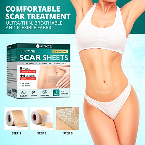 Silicone Scar Sheets, 1.6"x 120" Roll Z4540