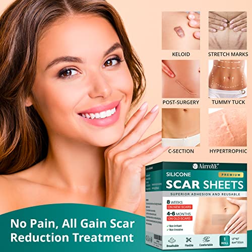 Silicone Scar Sheets, 1.6"x 120" Roll Z4540