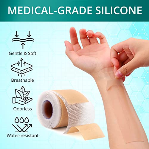 Silicone Scar Sheets, 1.6"x 120" Roll Z4540